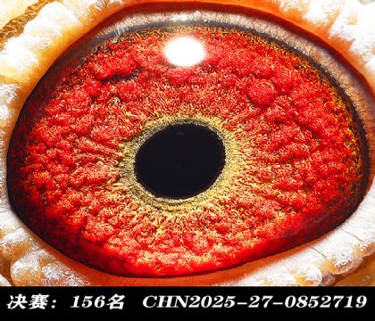 ���156-