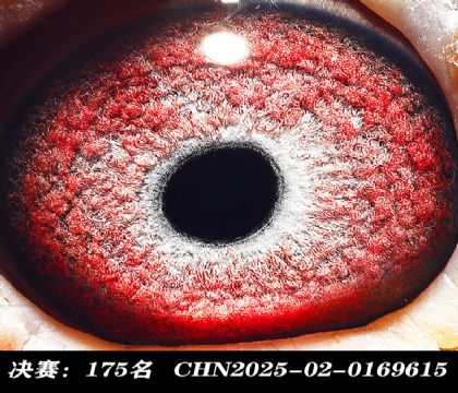 ���175-