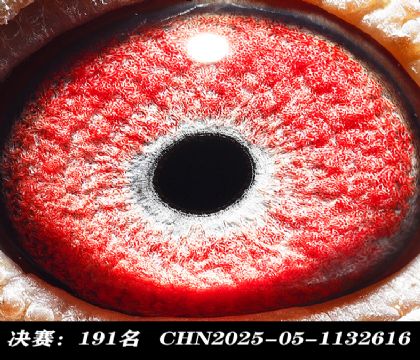 ���191-