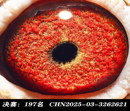 ���197-